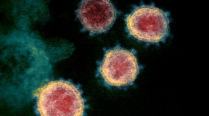 coronavirus 1